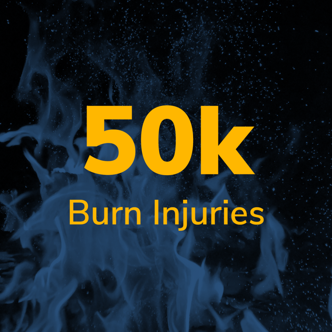 50k burn injuries